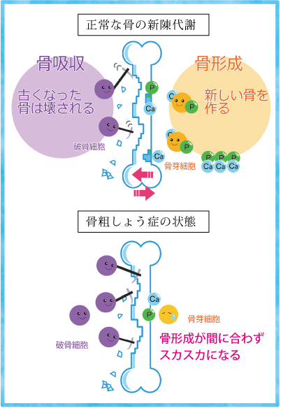 骨の新陳代謝